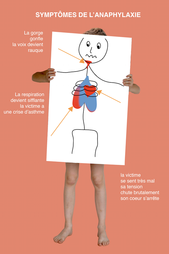 Et si mon enfant mourrait en mangeant un gâteau ?