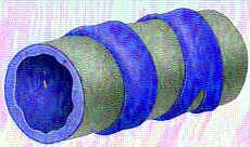Bronche