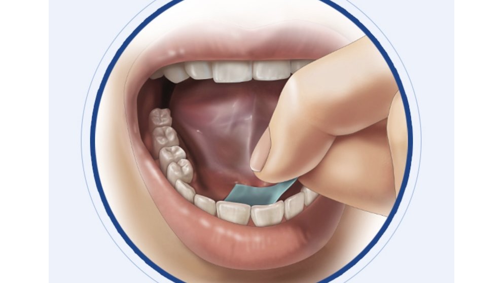 Anaphylm : le traitement sublingual de l'anaphylaxie