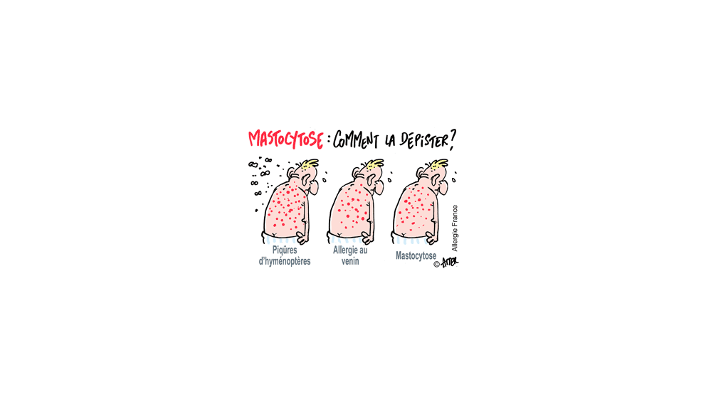 Gare à la masse « Tocytose » elle peut tassomer ton allergique !