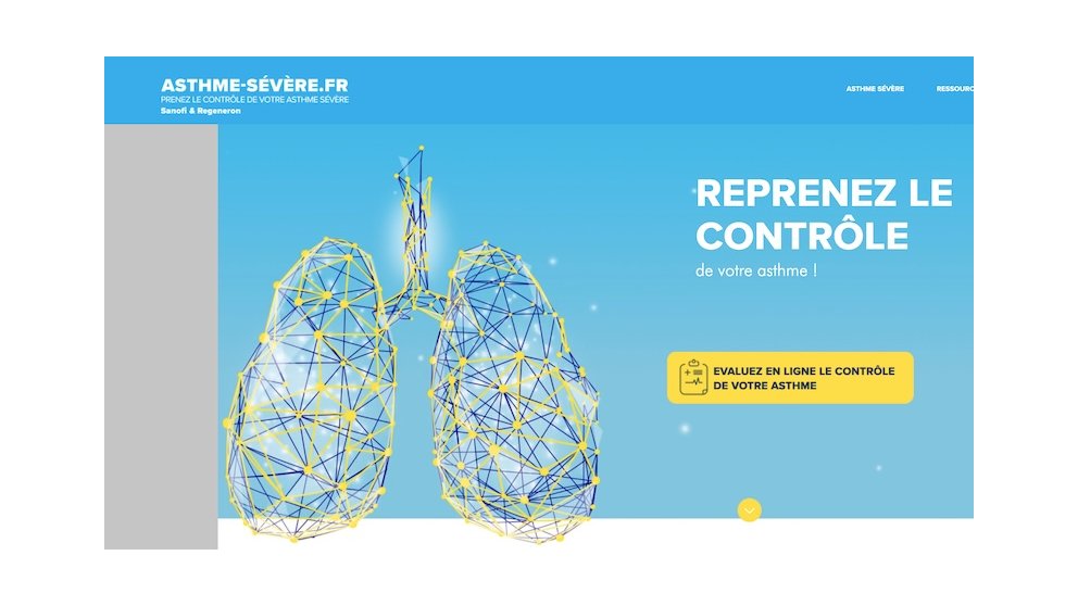 Votre asthme est-il bien contrôlé ?