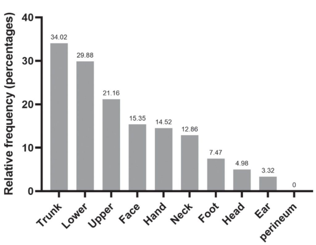 Eczéma atopique : et vous ? Quand vous grattez vous ?