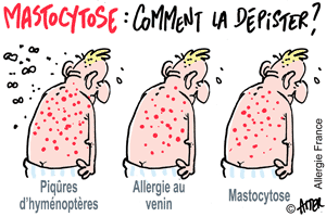 Gare à la masse « Tocytose » elle peut tassomer ton allergique !